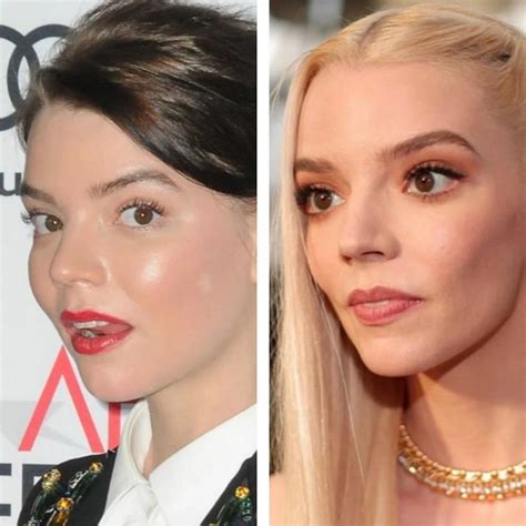 anya joy taylor plastic surgery